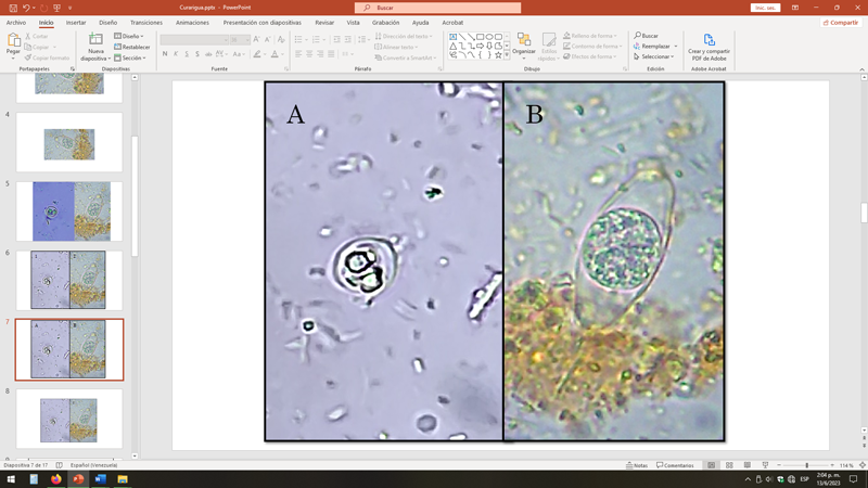 Figura 2. A la izquierda, un ooquiste de Eimeriasp (A); a la derecha, un ooquiste de Cystoisospora belli (B).