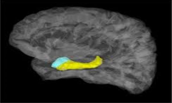 Figura 1. Hipotálamo y amígdala cerebelosa